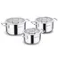 ქვაბების ნაკრები Korkmaz A2930 Stella 6 pcs Cookware Set - Primestore.ge